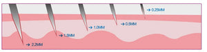 DRS 540 Roller Derma 0.2 / 0.25 / 0.3mm